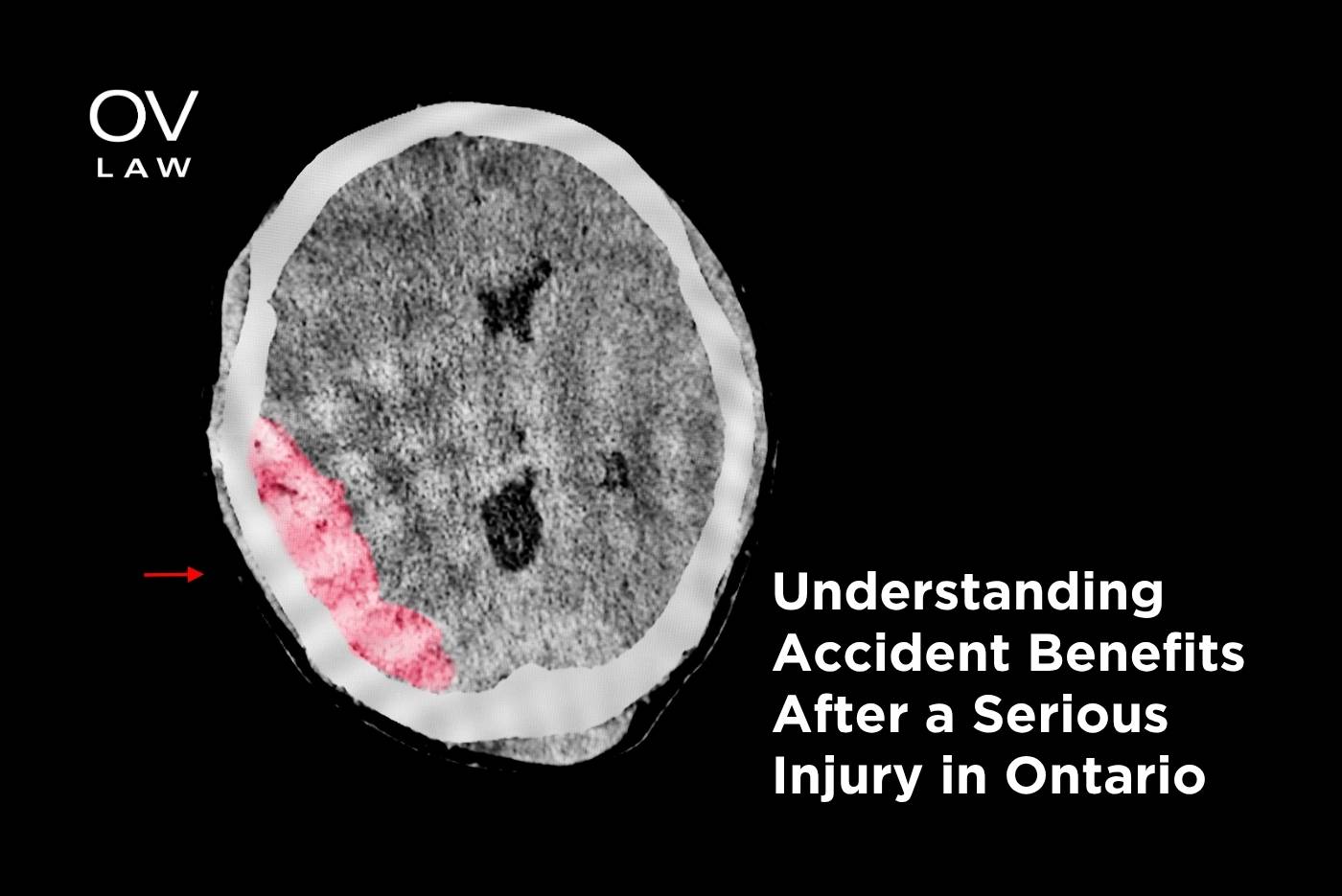 Understanding Accident Benefits After a Serious Injury in Ontario